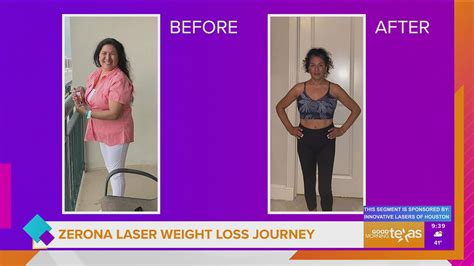 Zerona Laser Weight Loss Journey | wfaa.com