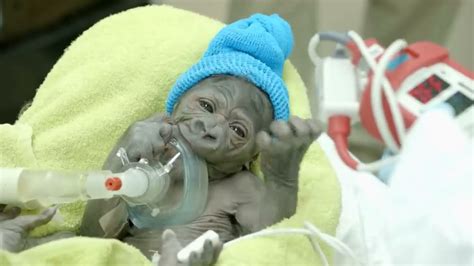 Baby Gorilla Born By Rare C-Section at San Diego Zoo Safari Park - YouTube