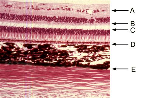 Eye | histology