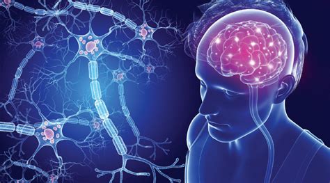 What are usually the early symptoms of Multiple Sclerosis? - MedClique