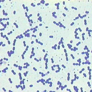 Enterococcus faecium | Microchem Laboratory