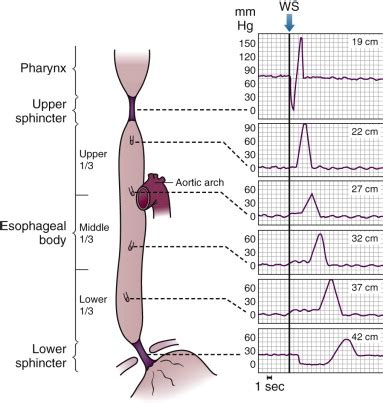 Motility Disorders of the Esophagus | Radiology Key