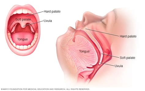 Soft palate cancer - Symptoms and causes - Mayo Clinic