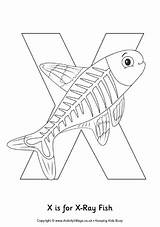 X Ray Printable Coloring Pages  Reference sketch template