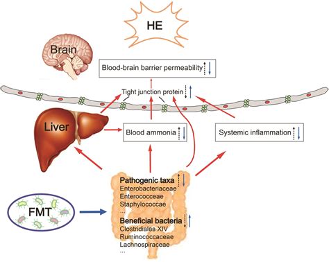 Fecal Microbiota Transplantation for Treating Hepatic Encephalopathy: Experimental and Clinical ...