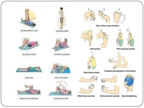 Physiotherapy management for rheumatoid arthritis