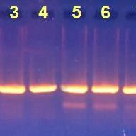 Agarose gel electrophoresis image that show the PCR product of Cp15... | Download Scientific Diagram