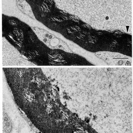 Electron micrograph. Axosomatic synapse of a cervical alpha motor ...