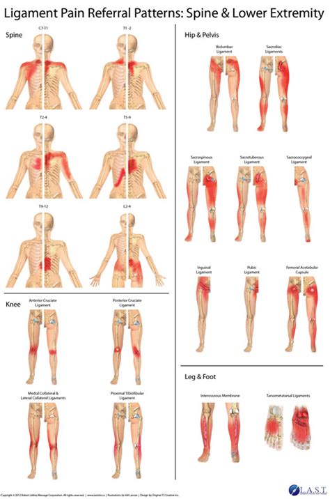 Shoulder Pain Referral Patterns are Reported in This Study - LASTechnique