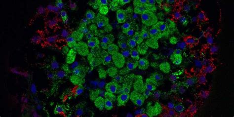 New diabetes targets could allow protection of pancreatic beta cells