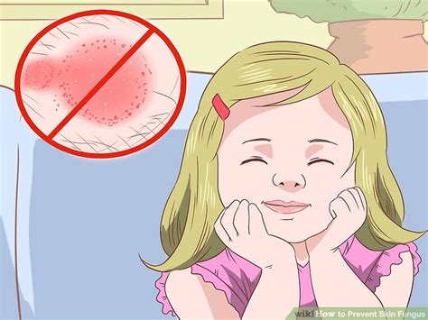 How to Prevent Skin Fungus (with Pictures) - wikiHow