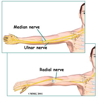 Median Nerve Palsy