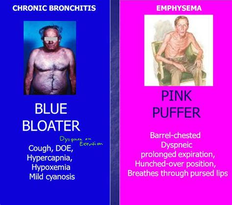 BLUE BLOATER vs PINK PUFFER - MEDizzy