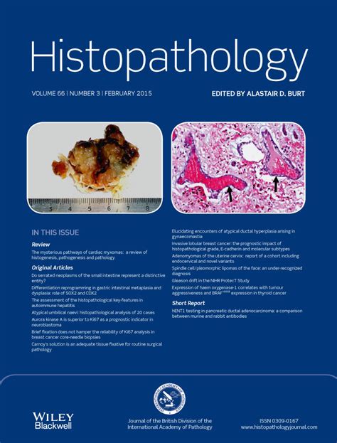 Carnoy's solution is an adequate tissue fixative for routine surgical pathology, preserving cell ...