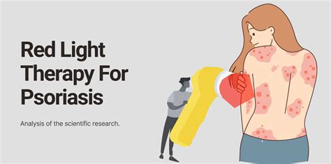 Red Light Therapy for Psoriasis: Review Of The Scientific Research – curalights.com