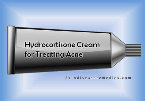 Cortisone Cream for Treating Acne - Skin Disease Remedies