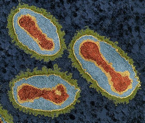 Smallpox viruses - Stock Image - M050/0725 - Science Photo Library