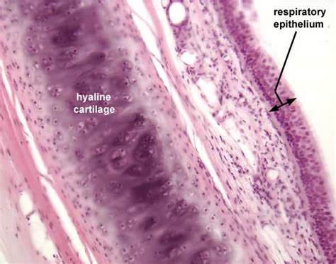 Tracheal Cartilage Histology