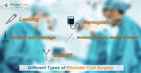 Different Types of Pilonidal Cyst Surgery