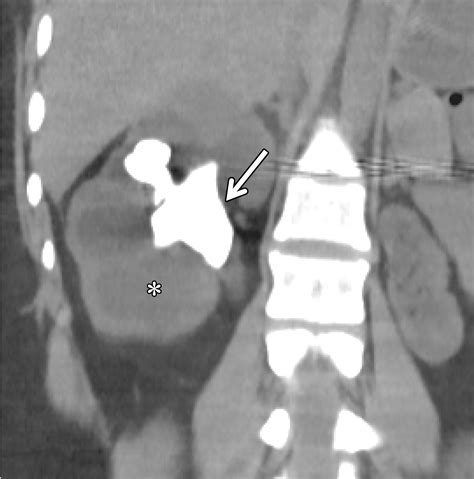 US of Right Upper Quadrant Pain in the Emergency Department: Diagnosing beyond Gallbladder and ...