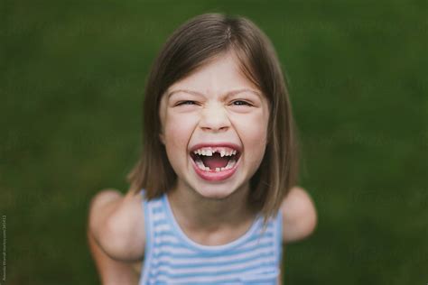 "Joyful Smile Of Girl With Missing Teeth" by Stocksy Contributor "Amanda Worrall" - Stocksy