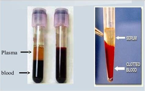 Difference between Serum and Plasma - Laboratoryinfo.com