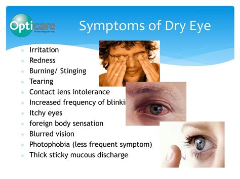 PPT - Dry Eye PowerPoint Presentation, free download - ID:7133318