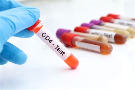 CD4 Test To Look for Abnormalities from Blood Stock Image - Image of ...