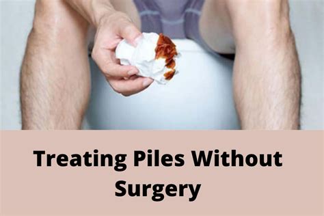 Treating Piles Without Surgery