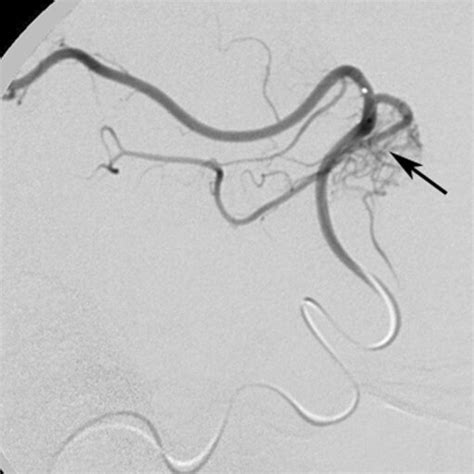 Whereas the feeder type in Fig. 6 was of the terminal or “direct” type,... | Download Scientific ...