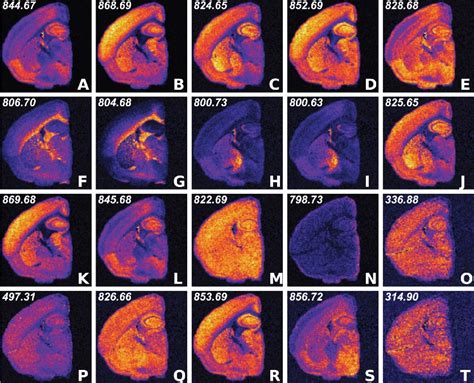 ‘Data Deluge’ Pushes Mass Spectrometry Imaging to New Heights