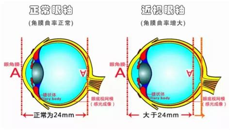 首份《世界视力报告》点名中国孩子，同样玩手机，为何美国近视率只有我们1/7? - 知乎