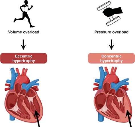 This figure illustrates physiological hypertrophy resulting from ...