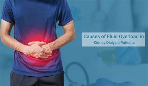 AKDC | causes-of-fluid-overload-in-kidney-dialysis-patients