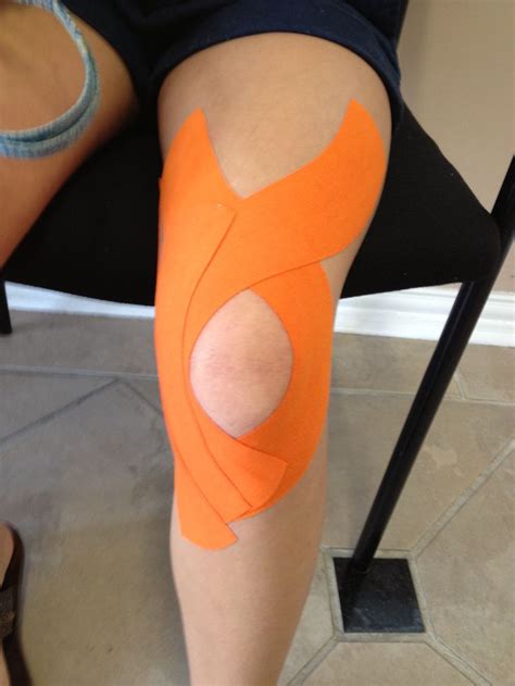 Patellar Tracking Support | Kinesiology Taping | Pinterest