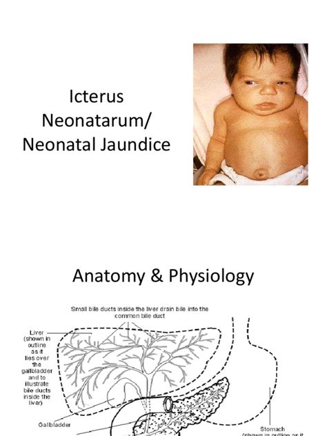 Icterus Neonatarum | PDF | Health Sciences | Medicine