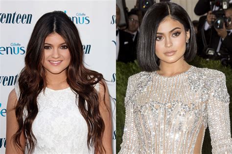 This Is What It's Really Like to Plan a Secret Celebrity Plastic Surgery Appointment - NewBeauty