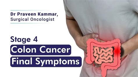 How to Spot the Last Symptoms of Colon Cancer | Dr. Praveen Kammar