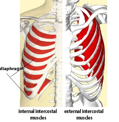 Intercostal Muscle Strain - Physiopedia