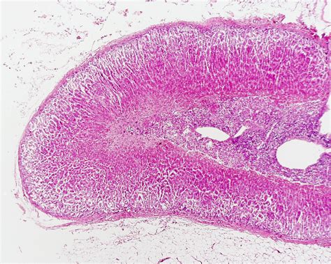 File:Adrenal histology 011.jpg - Embryology