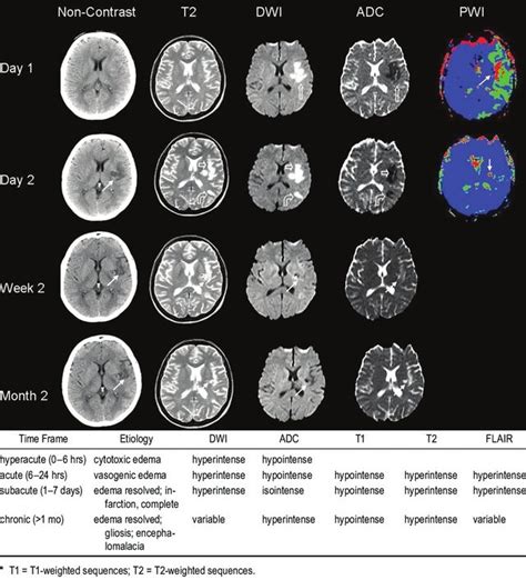 Mri Siemens Sequences Chart