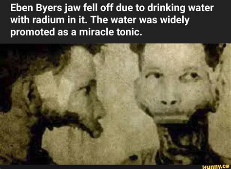 Eben Byers jaw fell off due to drinking water with radium in it. The water was widely promoted ...