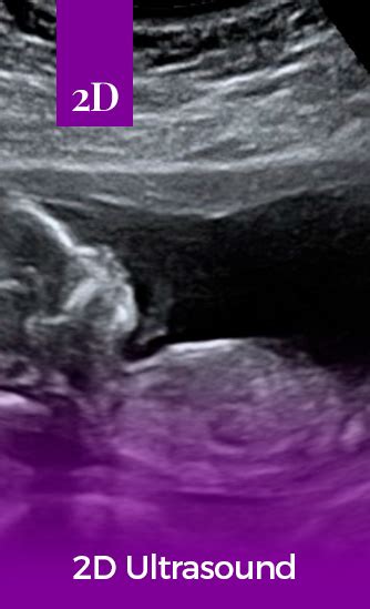 Hello Baby 4D Ultrasound Studio