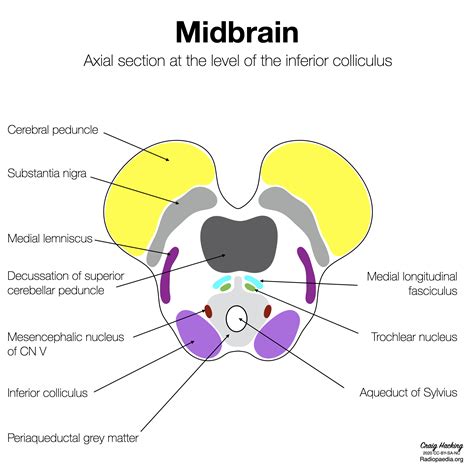 Inferior Colliculus Cross Section