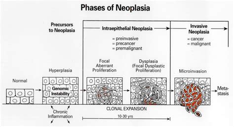 Neoplasia And Cancer Diagram