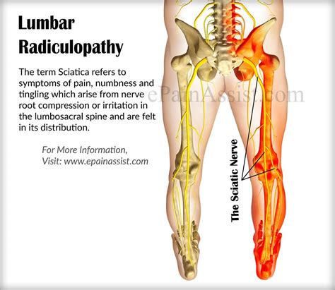 Pin on medical info