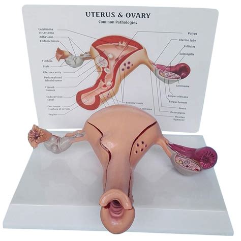 Buy LXX Human Anatomical Uterus Teaching Model - Uterus Ovary ...