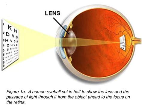 Crystalline Lens and Cataract by Joah F. Aliancy and Nick Mamalis ...