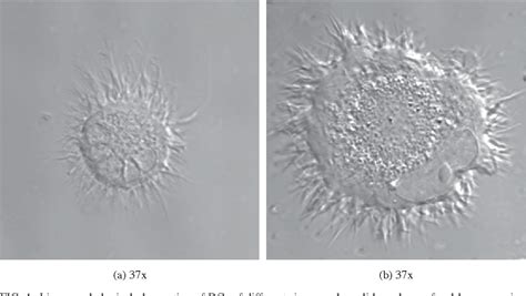 [PDF] Observation of dendritic cell morphology under light, phase ...