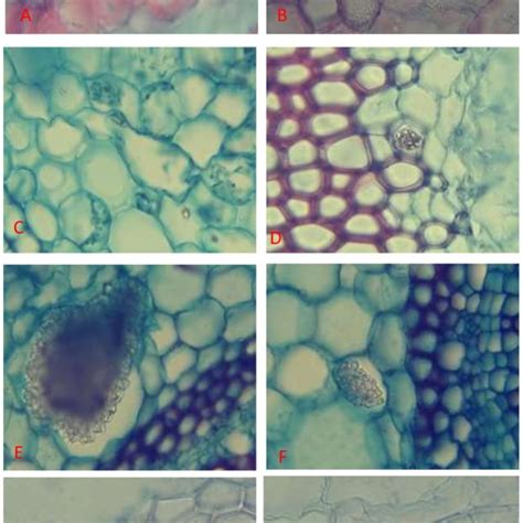 Plants contain different types of calcium oxalate crystals in stems ...